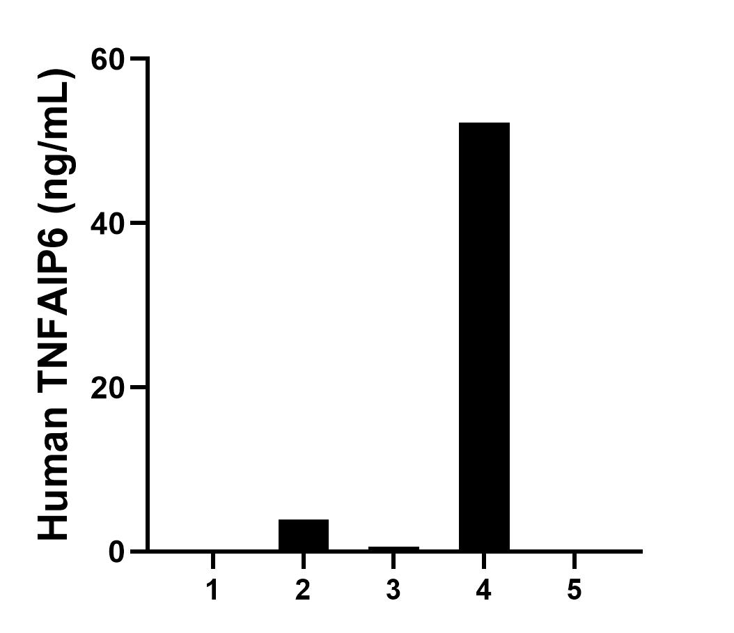 Serum of five individual healthy human donors was measured. The human TNFAIP6 concentration of detected samples was determined to be 11.38 ng/mL with a range of 0.03-52.26 ng/mL.													